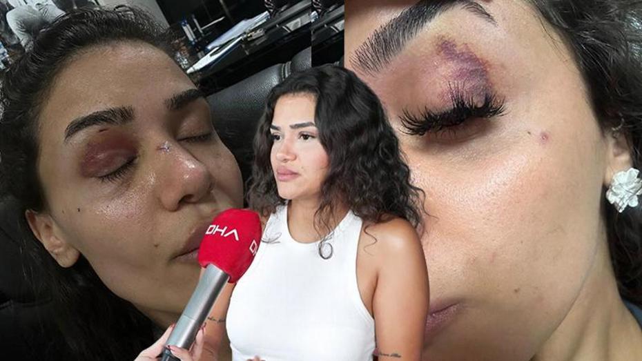 Ebru hemşirenin Çığlığı: Şiddet ve Tehditler İçinde Hayat Mücadelesi
