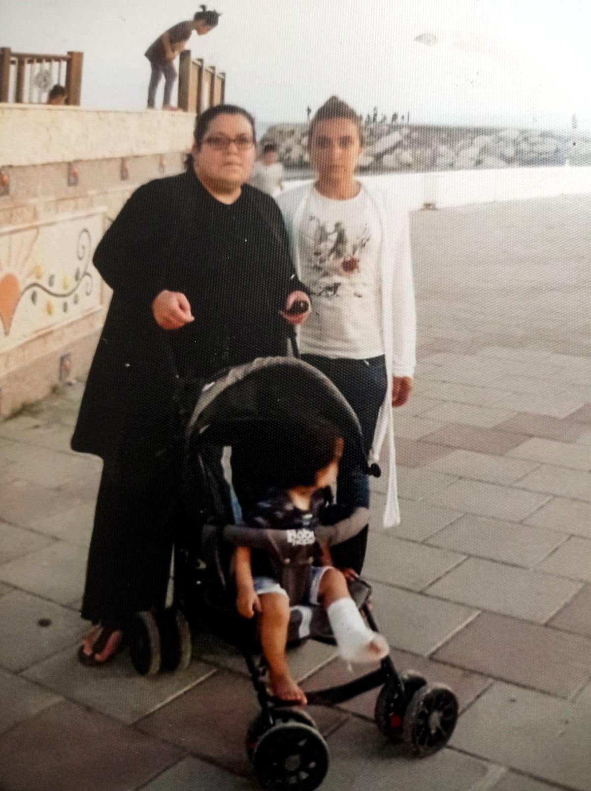 Önce ayağı şişti, sonra yürüyemedi! Filin hastalığı hayatını alt üst etti 3